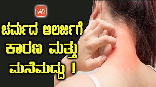 ಚರ್ಮದ ಅಲರ್ಜಿಗೆ ಕಾರಣ ಮತ್ತು ಮನೆಮದ್ದು   Skin Allergy Remedies in Kannada  YOYO TV Kannada Health [upl. by Draw738]