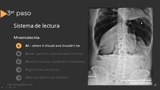 Radiografía de Abdomen Paso a Paso [upl. by Beverly]