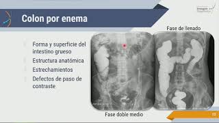 Radiología de Abdomen Estudios Contrastados [upl. by Jerrylee]