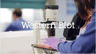 Western blot protocol video [upl. by Dahsraf]