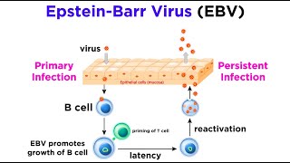 Mononucleosis EpsteinBarr Virus [upl. by Torrie]