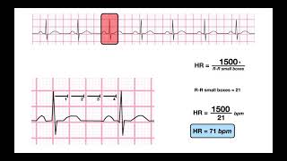 Determine HR from a RegularRhythm EKG  1500 amp 300methods [upl. by Eenot962]