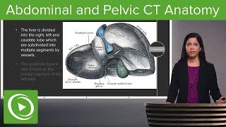 Normal Abdominal amp Pelvic CT Anatomy Algorithm – Radiology  Lecturio [upl. by Ianteen]