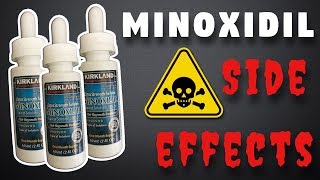 Minoxidil Side Effects  What To Expect [upl. by Levina178]