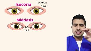 Isocoria  anisocoria  midriasis  Miosis [upl. by Ariay]