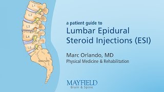 Lumbar Epidural Steroid Injections [upl. by Naened126]