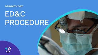 EDampC Procedure Overview Dermatology [upl. by Hedwiga]