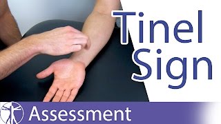 Tinel Sign Wrist  Carpal Tunnel Syndrome Diagnosis [upl. by Alf]