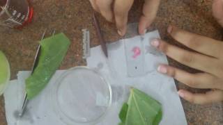 Preparation of Stomata slide [upl. by Analram440]