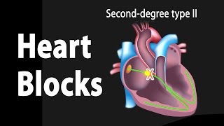 What You Need To Know About Echocardiograms [upl. by Katy52]