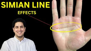 Simian Line in Palmistry [upl. by Aneis443]