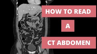 How to read a CT Abdomen for Med students and Residents  Part 1 [upl. by Sine91]