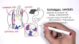 G I Motility  Gastrointestinal  Part 1 [upl. by Grube]