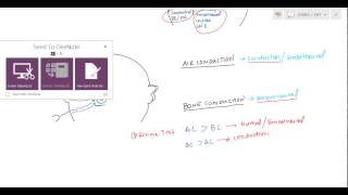 Weber and Rinne Tuning Fork tests for USMLE [upl. by Cleopatre]