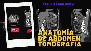 ANATOMIA DE ABDOMEN POR TOMOGRAFIA [upl. by Krissie414]