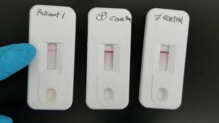 Immunology Infectious Mononucleosis Test [upl. by Samella]