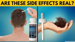 REAL TRUTH About Minoxidil Side Effects [upl. by Merissa]