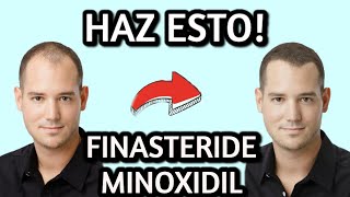 FINASTERIDE y MINOXIDIL Tratamiento ALOPECIA Como usarlos Efectos secundarios [upl. by Ahsekam990]