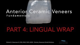 Anterior Ceramic Veneers Part 4 Lingual Wrap [upl. by Eelyek]