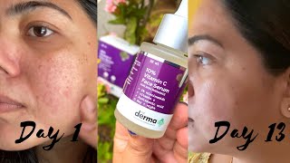 Derma co vitamin C 10  niacinamide 5 serum  oily acne prone skin REVIEW best vitamin C in India [upl. by Ahsinyd603]