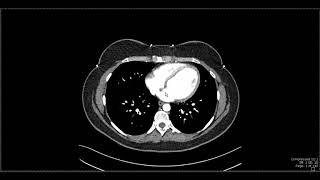 Abdominal Anatomy on Computed Tomography [upl. by Rugen]