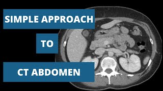 How to read a CT Abdomen  Part 2 [upl. by Odnesor]