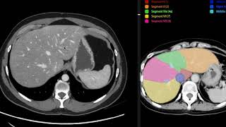 Anatomia de abdomen y pelvis por tomografia computada [upl. by Holub]