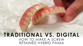 Traditional vs Digital How to make Screw Retained Hybrid PMMA [upl. by Eedahs710]