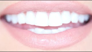 How to Get Really White Teeth For Cheap  Kandee Johnson [upl. by Fife]